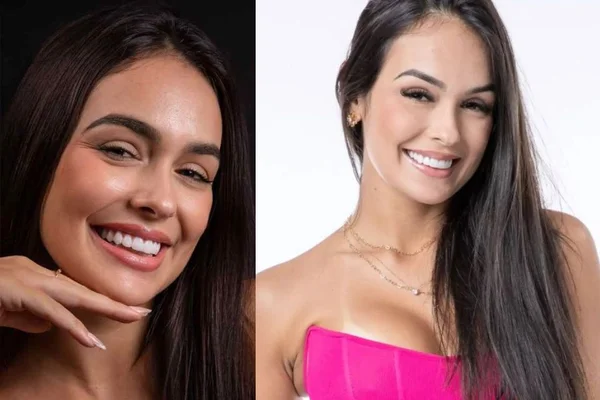 Ex-BBB23 Larissa passa por procedimento nos dentes. Saiba quanto custou