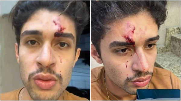 Casal é agredido por vizinhos e denuncia homofobia em Belo Horizonte