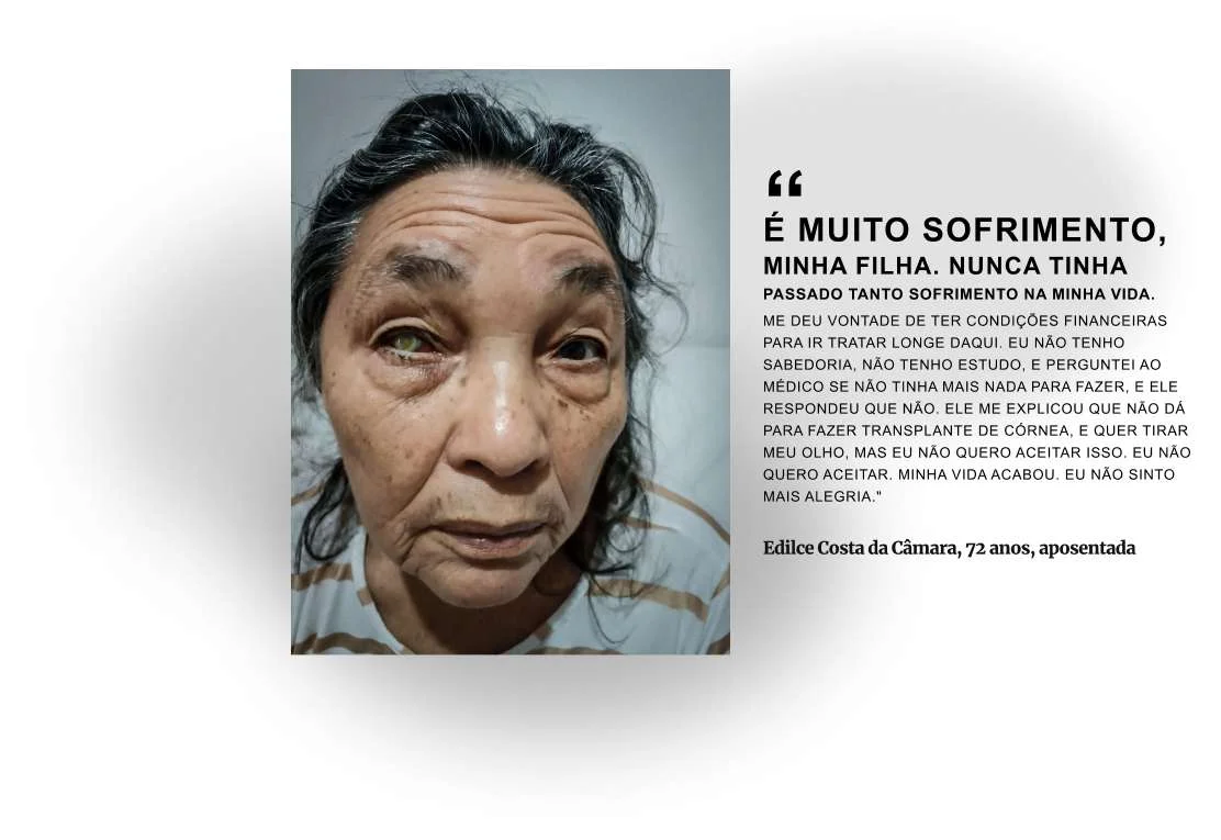 Relato de dona Edilce, paciente do Mais Visão. Ela fez a extração do olho na quinta-feira da semana passada Relato de dona Edilce, paciente do Mais Visão. Ela fez a extração do olho na quinta-feira da semana passada