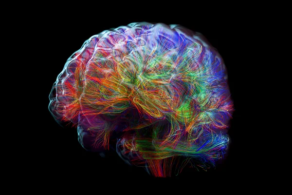 Ilustração mostra o formato do cérebro feito com linhas coloridas - Metrópoles