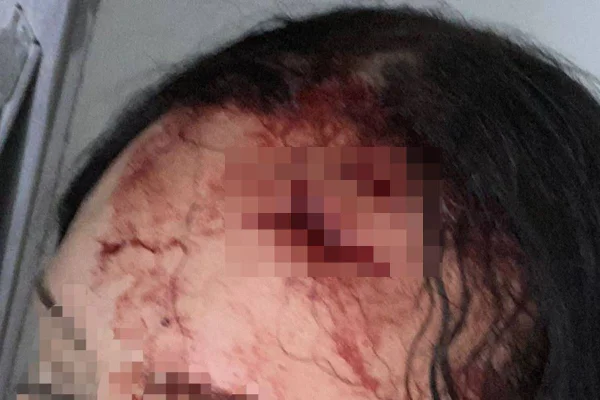 Após levar fora, homem rasga cabeça de mulher com garrafa no DF