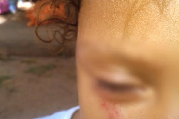 Mulher é denunciada pela própria irmã por maltratar filha no DF