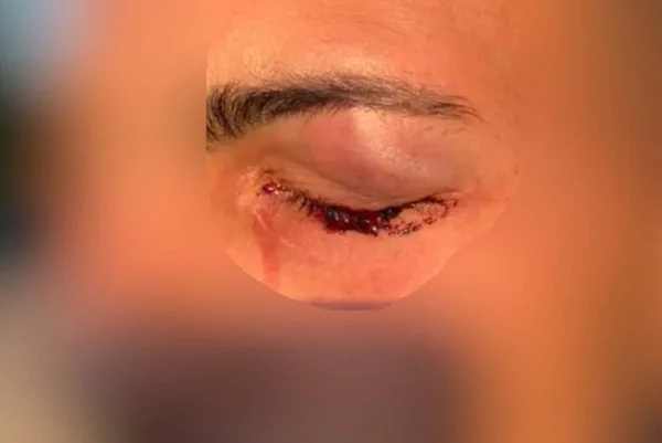 casal gay diz ter sido agredido por PM em goiânia, durante abordagem