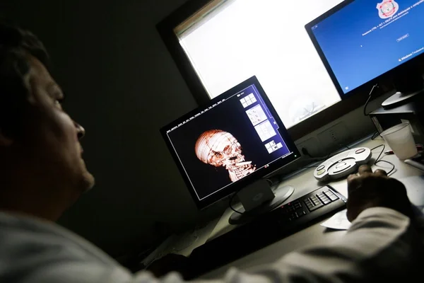 CSI Candango 2.0: autópsia virtual descarta abertura de corpos no IML