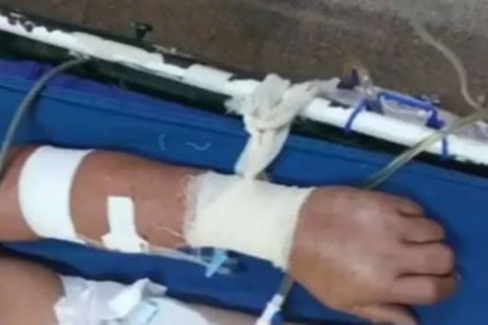 Pacientes com Covid-19 são amarrados a macas por falta de sedativo Pacientes com Covid-19 são amarrados a macas por falta de sedativo