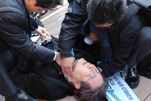 Imagem colorida de Lee Jae-myung após ser esfaqueado - Metrópoles