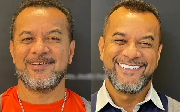 goias homem morre apos facetas dentarias