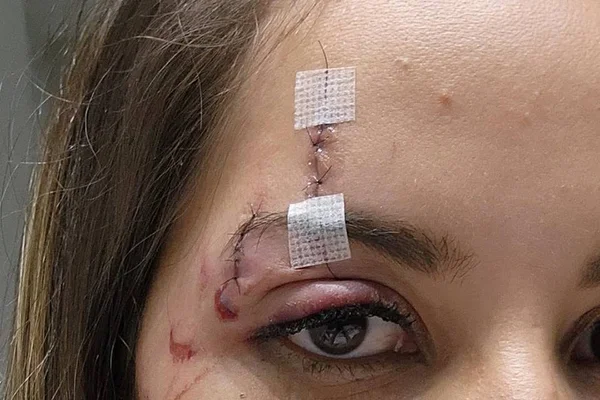 Mulher com o rosto ferido - Metrópoles