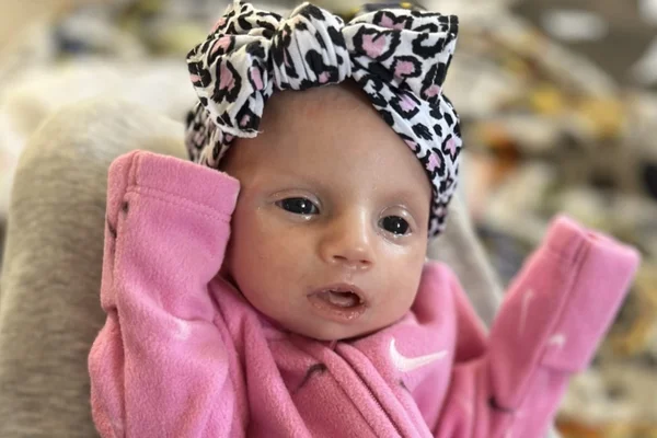 Bebe paralia facial não pisca não mama síndrome rara