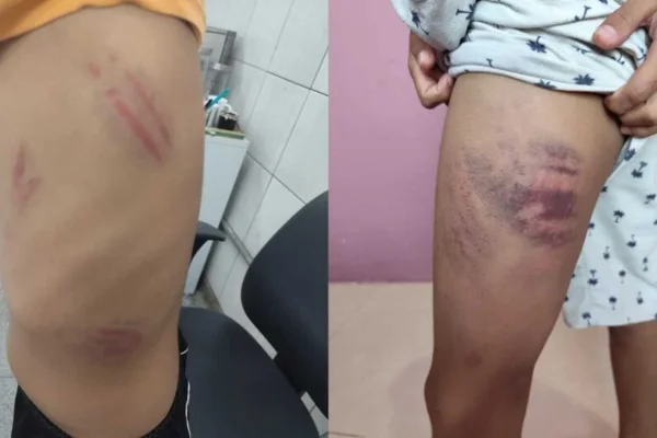Imagem colorida, Menino autista é espancado na escola em MS- Metrópoles