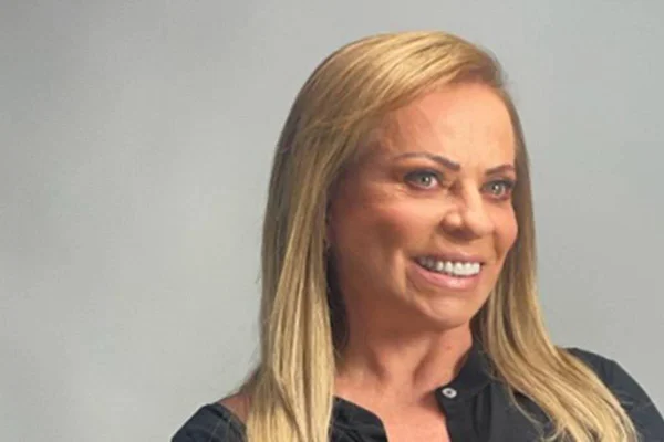 Veja como ficou o rosto de Christina Rocha após harmonização facial