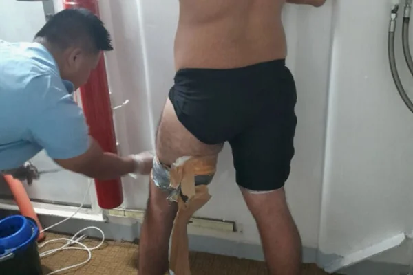 Imagem mostra turista francês preso com drogas presas ao corpo - Metrópoles