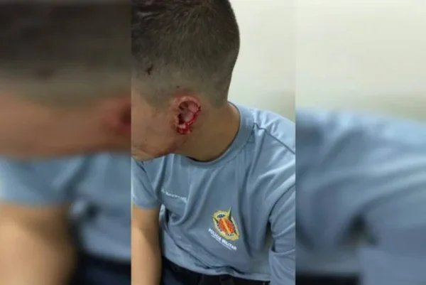 Cadeirante que trocou tiro com PM mordeu orelha de policial em 2020