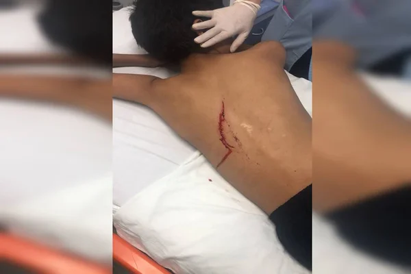 Criança de 12 anos é esfaqueada enquanto jogava bola na porta de casa