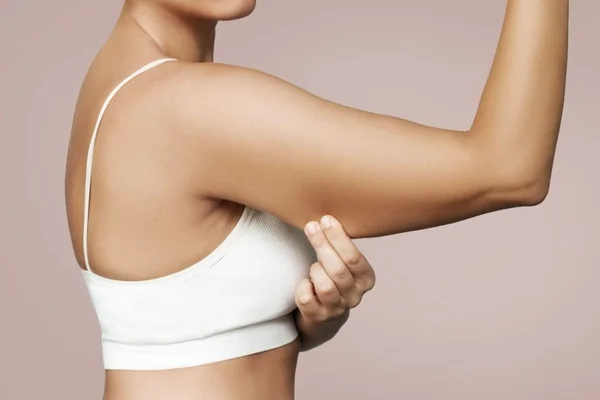 foto mostrando braço flácido de uma mulher com top branco