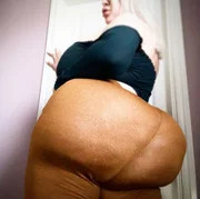 Modelo faz cirurgia para ter bumbum de 2 metros e impressiona - imagem 5