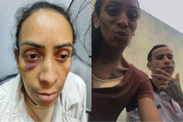 Imagem colorida mostra ferimentos de mulher após agressões do ex - Metrópoles