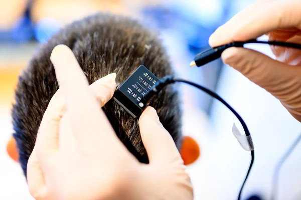 Pesquisadores conectam o chip cerebral de Ann ao computador sintetizador de voz.
