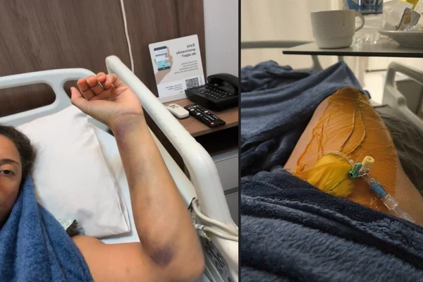 Imagens de Karina em hospital tratando tromboembolismo pulmonar - Metrópoles