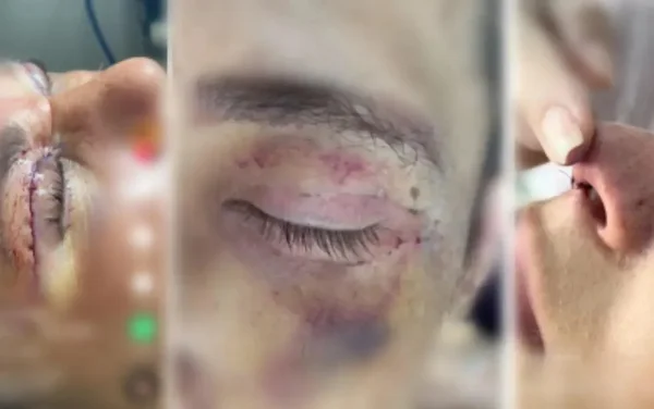 imagem colorida procedimento estetico realizado dentistas goias
