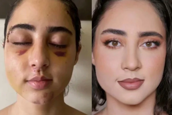 Mulher faz “make milagrosa” para carteira da OAB e impressiona web