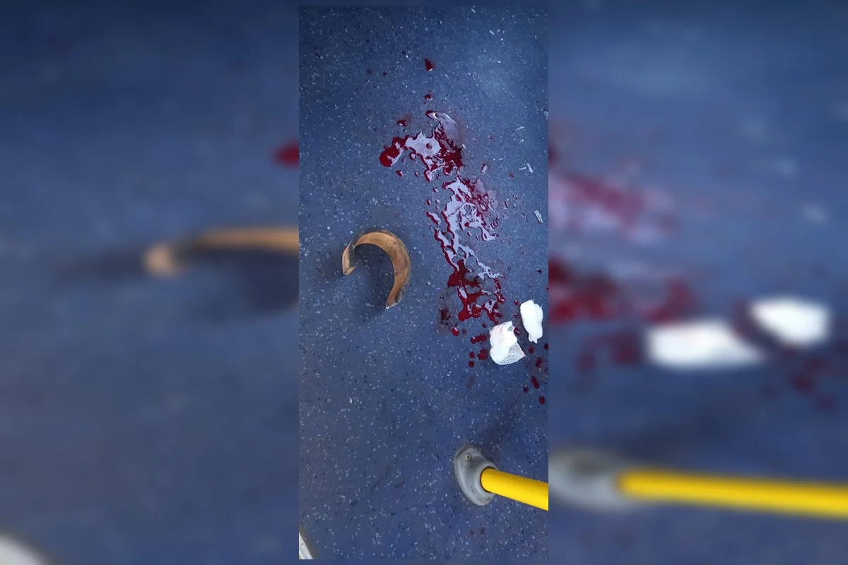 Peça de ferro atravessou o vidro lateral do ônibus e atingiu um passageiro de 27 anos no rosto, em Taguatinga Peça de ferro atravessou o vidro lateral do ônibus e atingiu um passageiro de 27 anos no rosto, em Taguatinga