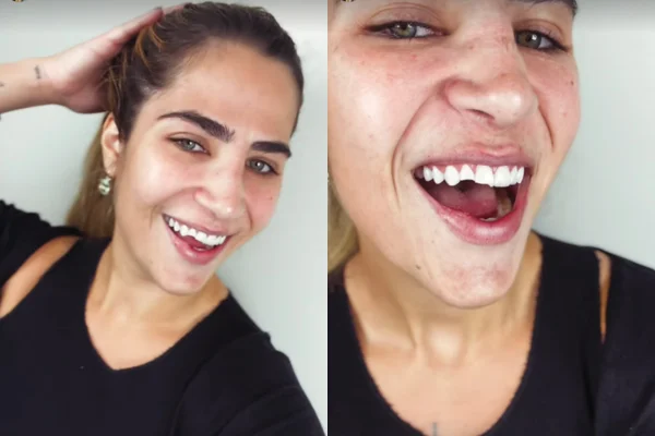 Filha de Leonardo desmaia, cai e quebra o dente