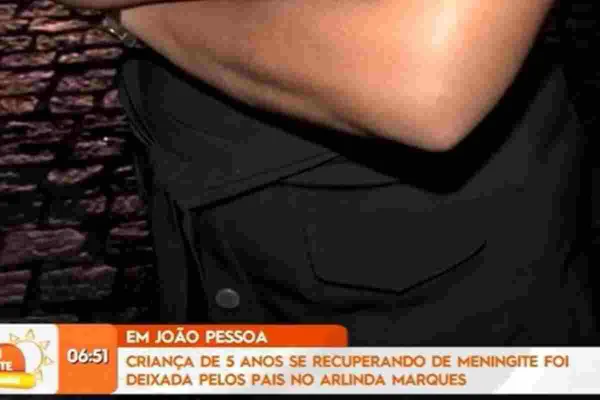 Braço de homem que testemunhou caso