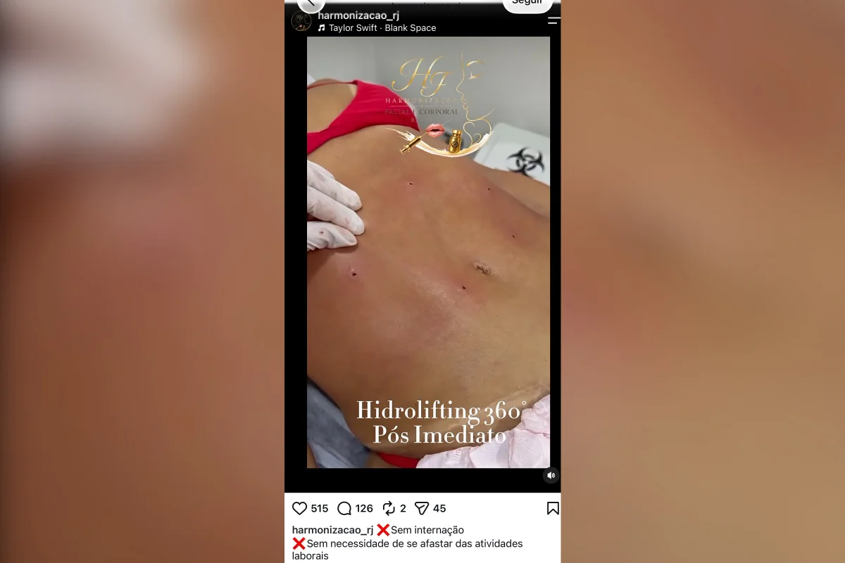 Clínica no RJ é denunciada por lipo irregular e rebate: “Ninguém morreu” - imagem 4 Clínica no RJ é denunciada por lipo irregular e rebate: “Ninguém morreu” - imagem 4