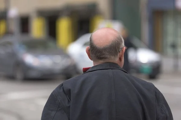 Foto colorida de homem careca de costas - Metrópoles