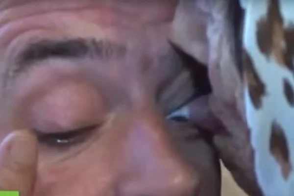 Idosa lambe os olhos de pessoas para curar problemas oculares