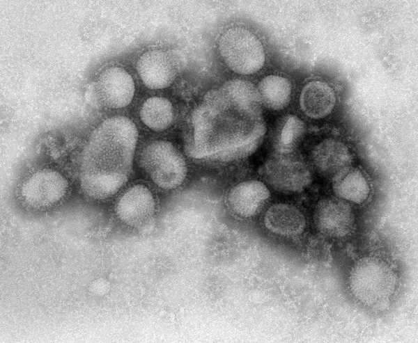 Um em cada três dos mortos por gripe H1N1 era cardíaco ou diabético