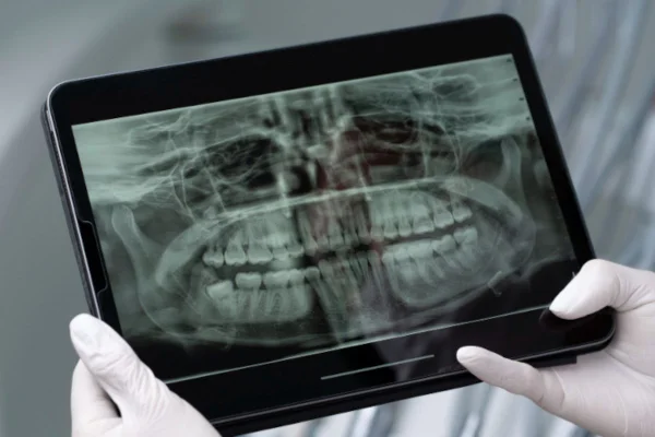 Imagem colorida mostra radiografia de dentes - Metrópoles