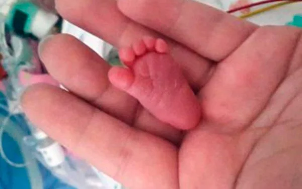 Emilia Grabarczyk, a menor bebê do mundo completa 9 meses