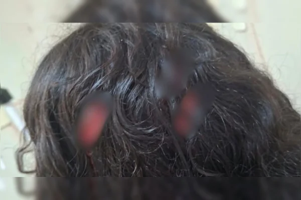 Cabeça da menina de 12 anos que foi esfaqueada
