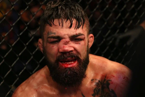Dez lesões impressionantes do MMA