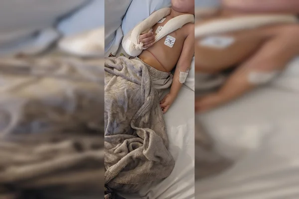 Imagem colorida de um menino, de pele clara, deitado em uma maca com um cobertor cinza cobrindo parte do corpo. Ele tem o braço direito enfaixado