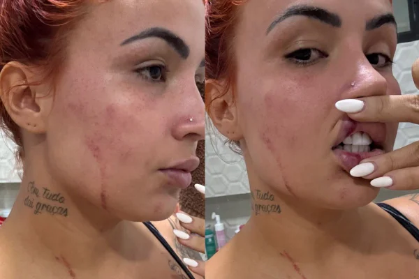 Influenciadora Ruivinha é baleada pelo ex-marido em perseguição em João Pessoa