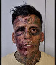 Leandro Souza passou por cirurgias para remover as tatugens Leandro Souza passou por cirurgias para remover as tatugens