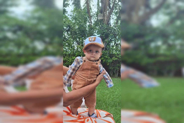 Família de bebê com deformidade atinge meta para comprar capacete