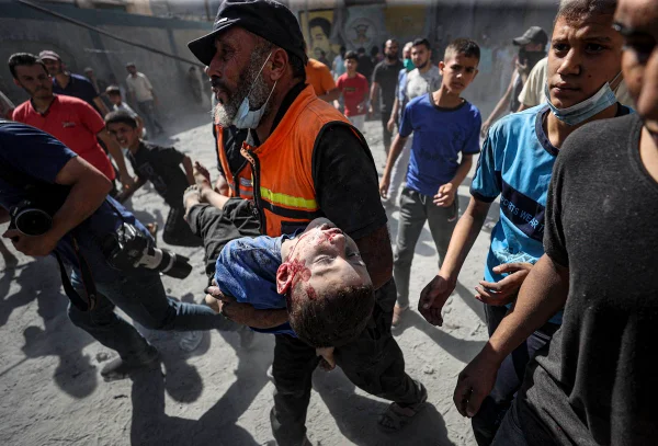 Criança coberta de sangue é socorrida após ser retirada dos escombros na cidade de Khan Yunis, Gaza - Metrópoles