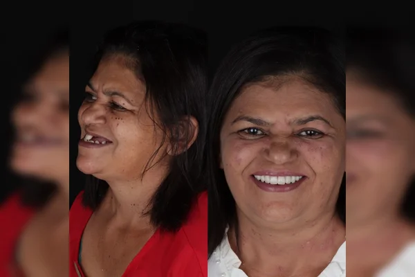 Mulher realiza sonho de fazer tratamento dentário