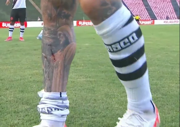 Rossi, do Vasco, mostra ferimento causado pelas travas da chuteira do adversário