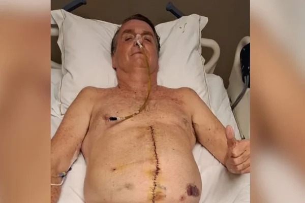 oficial Jair Bolsonaro após cirurgia