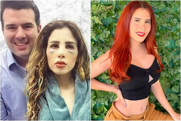 Youtuber é absolvida de processo por calúnia movido por cirurgião