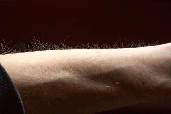 Close-up de pelos no braço arrepiados. Conceito de cuidados com a pele. Close-up de parte do corpo humano, mostrando a musculatura e as veias do braço.