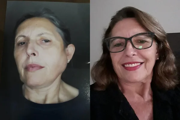 “Sentia dor até para me alimentar”, diz mulher com síndrome de Sjögren