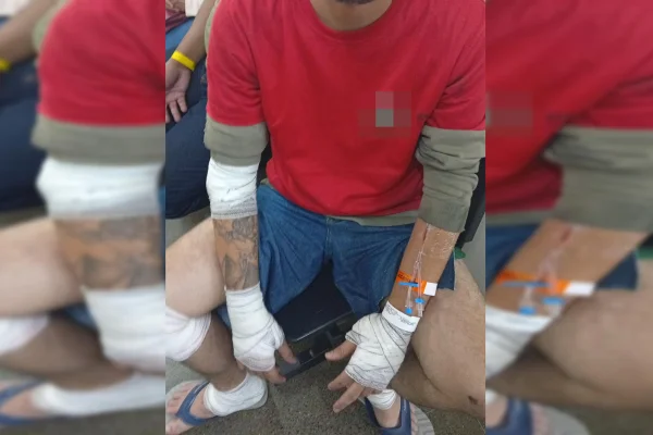 Motorista se irrita com tapa no retrovisor e atropela motociclista no Eixão