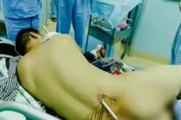Pedreiro é empalado por barra de ferro de 2 metros de comprimento