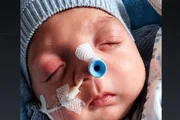 Noah Gabriel, de 2 meses, precisou ser internado na UTI logo depois de nascer Noah Gabriel, de 2 meses, precisou ser internado na UTI logo depois de nascer